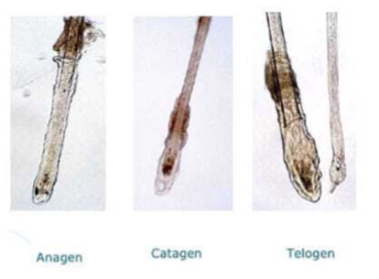 Peanaha mikroskoopia ja trihhogramm: Süvadiagnostika juuste tervise teenistuses